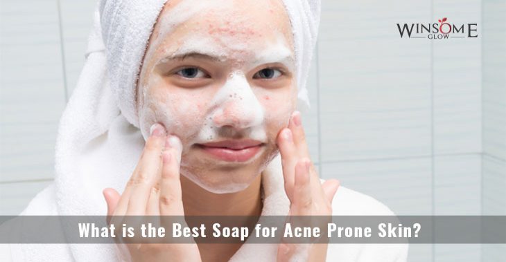 What is the Best Soap for Acne Prone Skin?